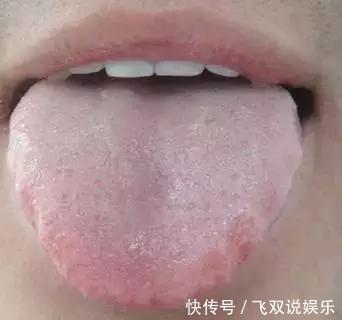 脾虚|中医坦言脾虚的人,至少4毛病!记住3个妙方,让脾胃强大起来