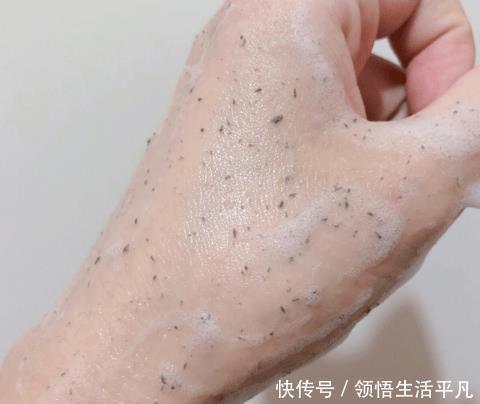 鼻子上挤出来的白色物体是什么皮肤科医生给出这些忠告