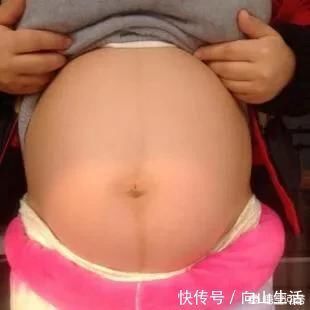 肚子|准妈妈肚子上为啥会有妊娠线?妊娠线会一直存在吗?