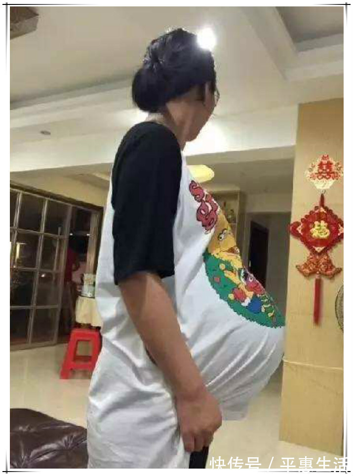 肚子|孕妇“悬垂肚”走红,网友猜测是“双胞胎”:没见过这样的孕肚