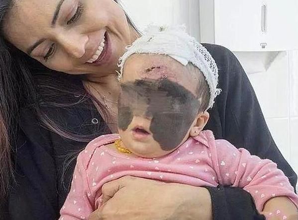 合照|宝妈生下“蝙蝠侠”胎记宝宝,发合照鼓励女儿,不料留言令她崩溃