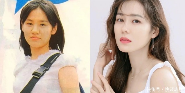 鼻尖抬高,鼻翼惊现疤痕,号称天然美女代名词的她,也翻车了?