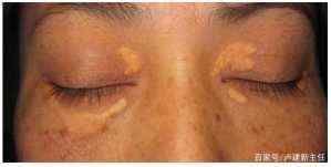 粗粮|这一种粗粮是公认的“降脂冠军”,血脂高的人经常吃,血管通透