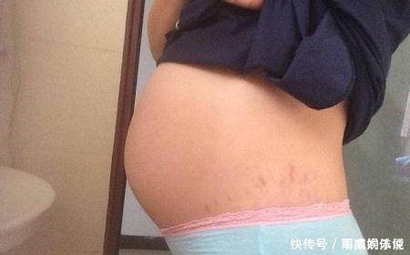 孕妇|孕妇生下二胎4个月后又怀孕了,这易孕体质的人是什么样!
