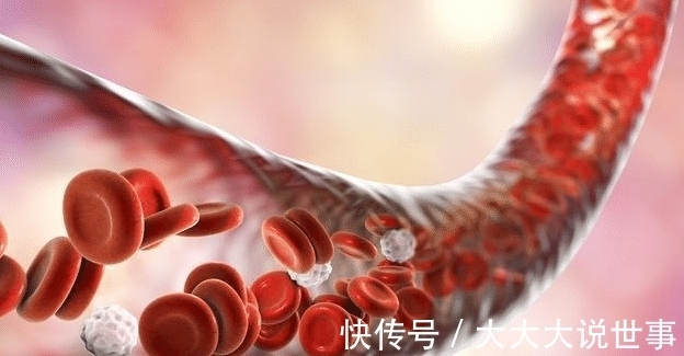 诊断|血常规能查出癌症吗？医生：“揪出”早期癌症，不要放过这3项