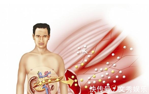 高血糖|血糖高不高,看脸就知道!若面部没4种表现,血糖还算稳定,恭喜