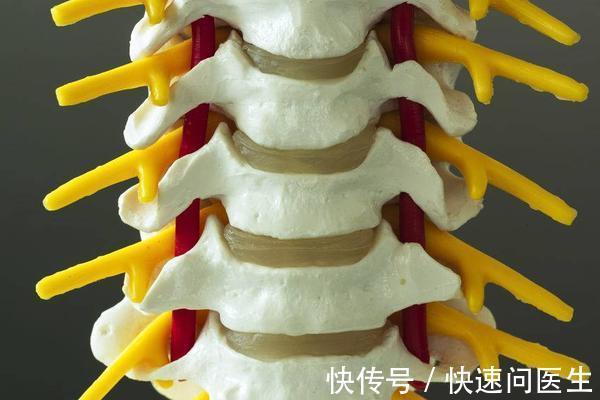 手术治疗|脖子经常咔咔响，是颈椎病吗？这3种情况也会引起颈椎咔咔响