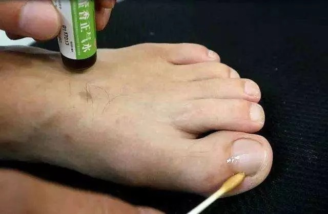 藿香正气水|藿香正气水的18种妙用！