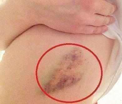 指甲|身体如果出现3种现象，说明癌症可能找上你了，尽早检查