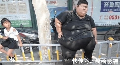 宝贝儿|把胃切掉一半,一年狂瘦400斤,史上第一胖的他,如今让人羡慕