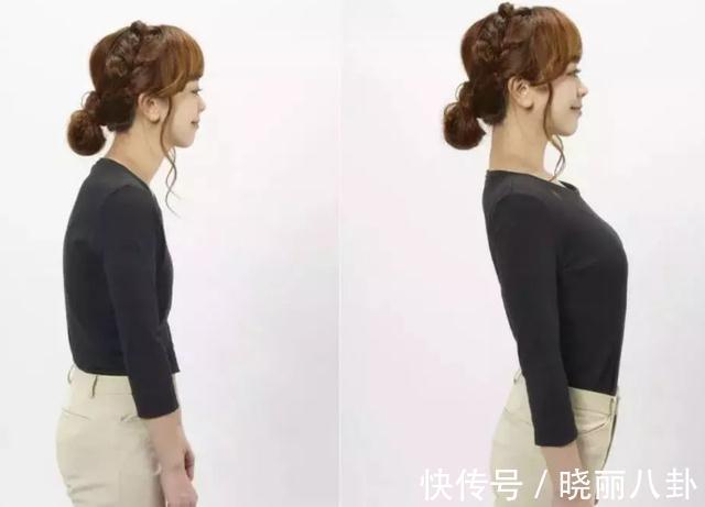 蔬菜|世卫组织呼吁:这种蔬菜或导致骨密度下降,中老年人尽量少吃