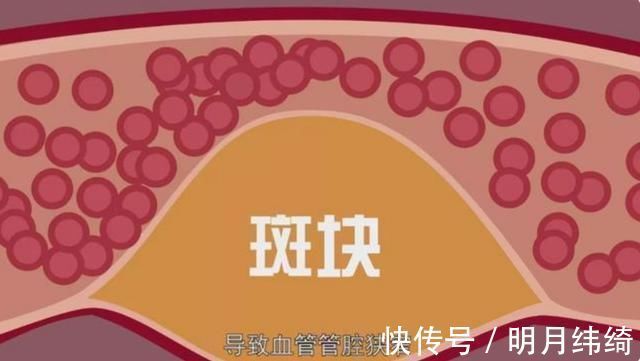 血压|长期服用降压药，身体或许会表现出5种变化，不妨了解一下