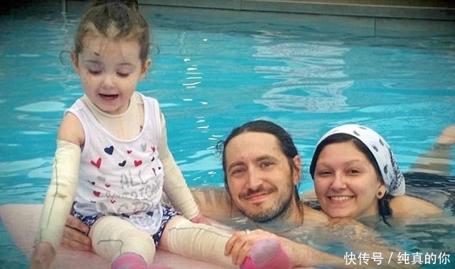 父母|父母每天将三岁女儿包裹成木乃伊，网友知道真相后感动落泪！