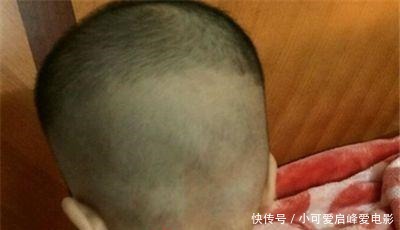 宝出生以后|囟门闭合的时间,对大脑发育有什么影响如果是第三种就该注意了