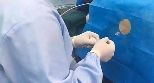 普及率|无痛分娩好处多,为何在我国的普及率只有10这些原因让人无奈