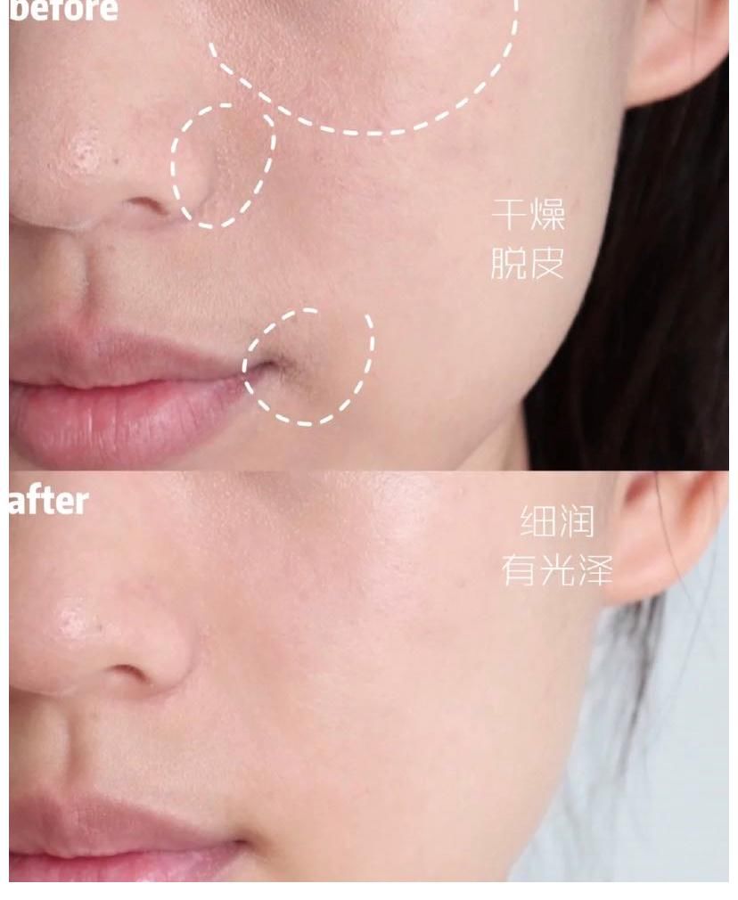 颜值|不想因怀孕毁了颜值？孕期护肤品“三选原则”，从此盲买也安全