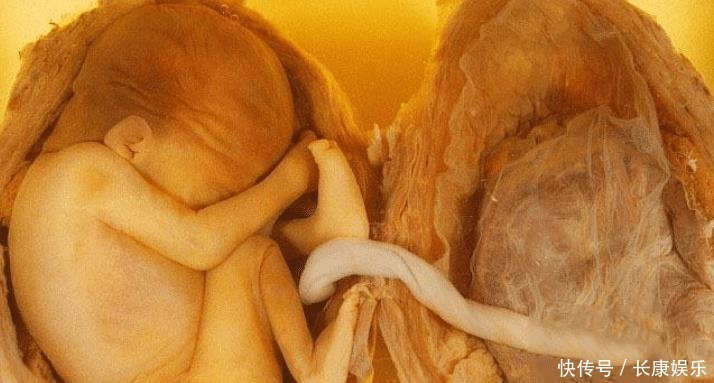 孕妇|孕妇怀孕3个月,肚子大到行动不便,孕检后一家人很纠结