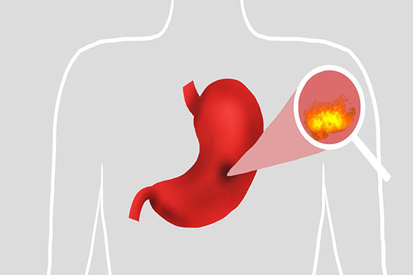绿豆|心火、肝火、胃火、肺火、肾火,表现不同,去火的方法也不同