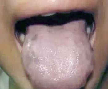 津不上承|老中医告诉你一到晚上就口干口渴的厉害是怎么回事