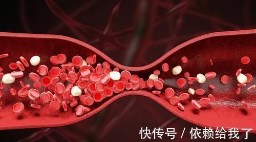 泡水|高血脂的“天敌”被发现，经常泡水喝，坚持1月，甘油三酯不见了