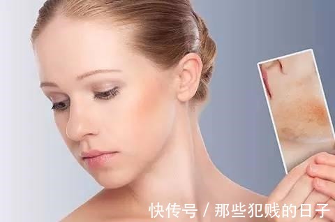 维生素a 新依美护肤不同季节的护肤干干干货,让肌肤不再干燥!