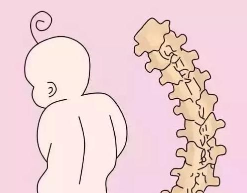 关节|妈妈抱宝宝姿势不对，易造成脊椎弯曲，这些常见错误可能你也在犯