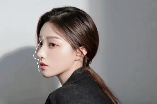 方法|瘦鼻子的有效方法是什么?几个小方法,让鼻子更小巧