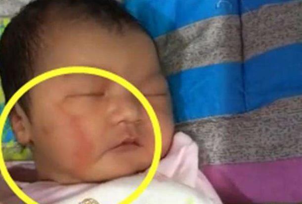 死亡|孕妇破水15小时,生产后娃“意外”死亡,家属孩子是被产钳夹死