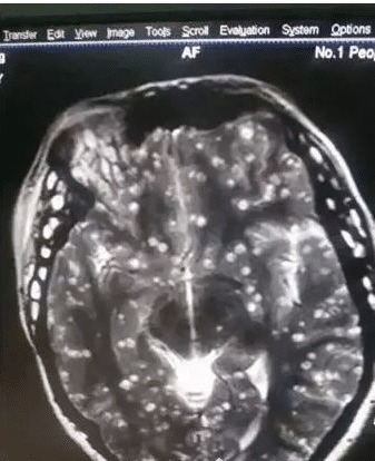 虫子|90后女大学生全身长满虫子,疼痛难忍送医时,医生却破口大骂