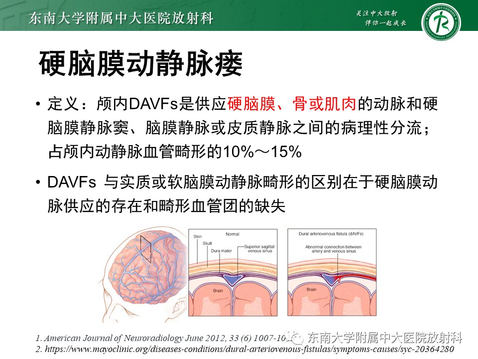 影像学|脑动静脉畸形影像学特征