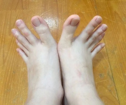 著作!林黛玉的病放到现代医学叫什么哈哈哈,网友“老抑郁了”