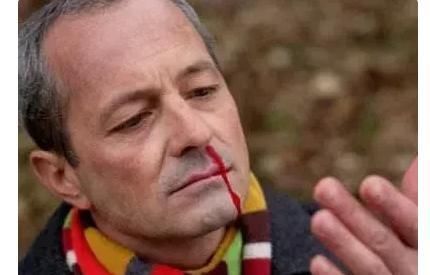 暗号|血栓发生当天会有6个暗号,收到1个就能救命!