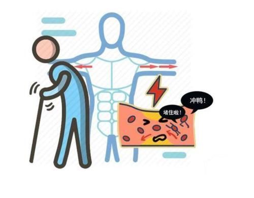 血管|养血管就是养寿！提醒：多吃2物、多喝2水，血管一天比一天通畅