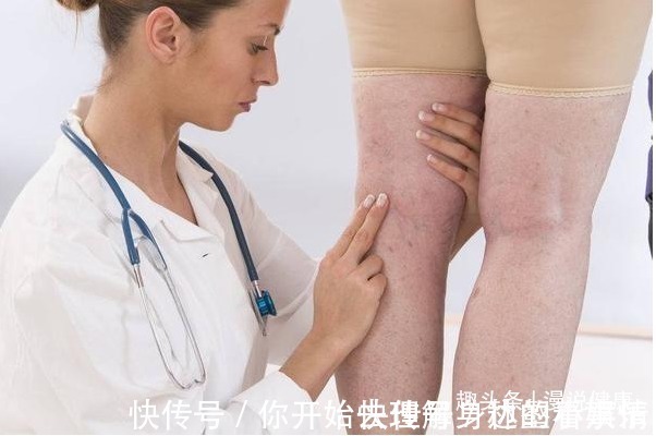 血管堵塞|深受血栓“偏爱”的人，有四个共性，若你没有，说明血管还不错