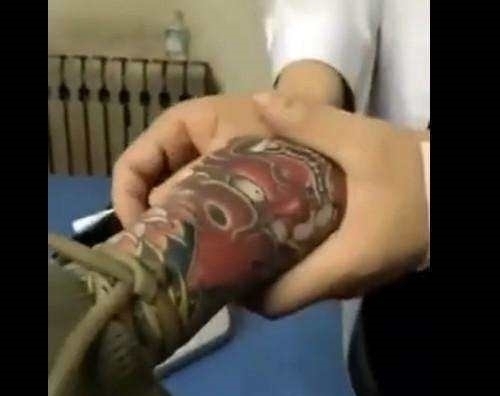 手臂|男子感冒去医院输液,护士看到他的手臂时,急得掉下了眼泪