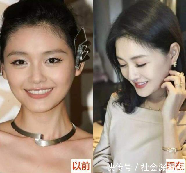 春夏秋冬|天生黑皮想逆袭成白皮大S教你3个美白秘诀,让你秒变少女肌