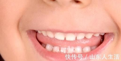 攻略|如果你的宝宝正在换牙,那么这份攻略你就得仔细看看了