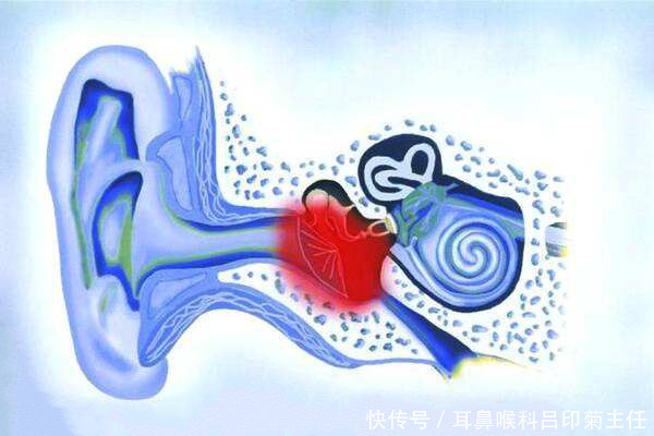 流脓|吕印菊医生:中耳炎流脓是怎么回事?