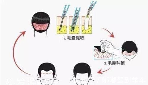 秃发 男人过了四十别剃“光头”,三种帅气发型,让油腻大叔变回小鲜肉!