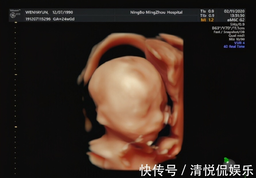 准爸爸|有种产检叫“准爸爸不能缺席”,这5项产检,准爸爸再忙也要来