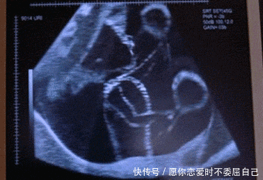 活动|什么样的胎动是好胎动?通过胎动辨异常的本领,孕晚期的你请查收