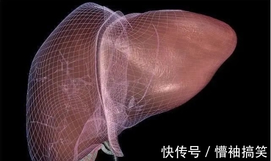 肝硬化|35岁男子常吃1“酸”,转氨酶从190降至40,肝脏柔软有活力