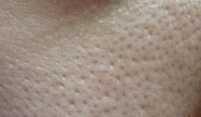 “大油田”与“毛孔粗大”是亲生兄弟,几招轻松对付他们