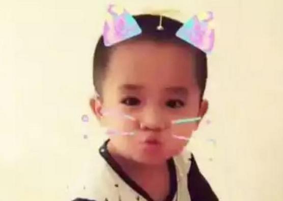 剪刀|4年前因吃奶太用力,被妈妈用剪刀划伤脸的男婴,现状如何了?