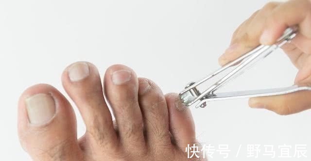 特征|长寿的人脚上有3个特征，若你占一个，也值得庆幸，自测一下吧