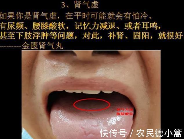 久病|气虚到底应该怎么补?中医师:分清这“4种”气虚,快速补气