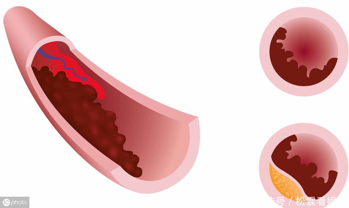 功效|家家有黄芪,用它加1宝,补气养肾百病消,几种黄金搭档了解下