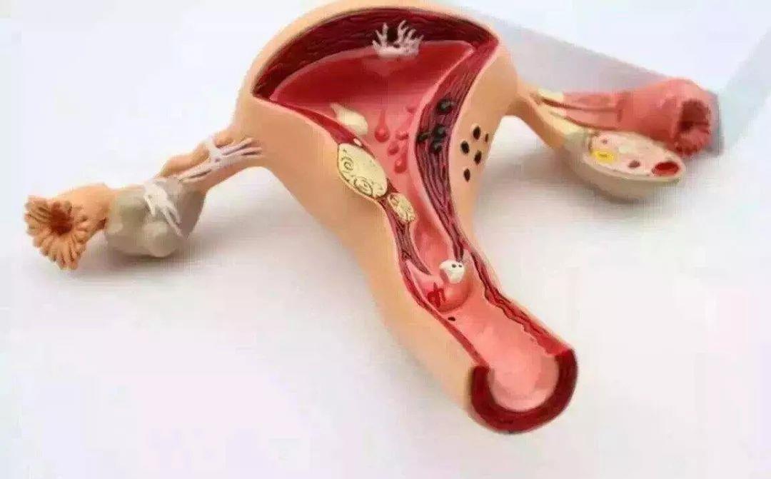 女人|月经不调危害大,备孕女人可“得罪不起”!