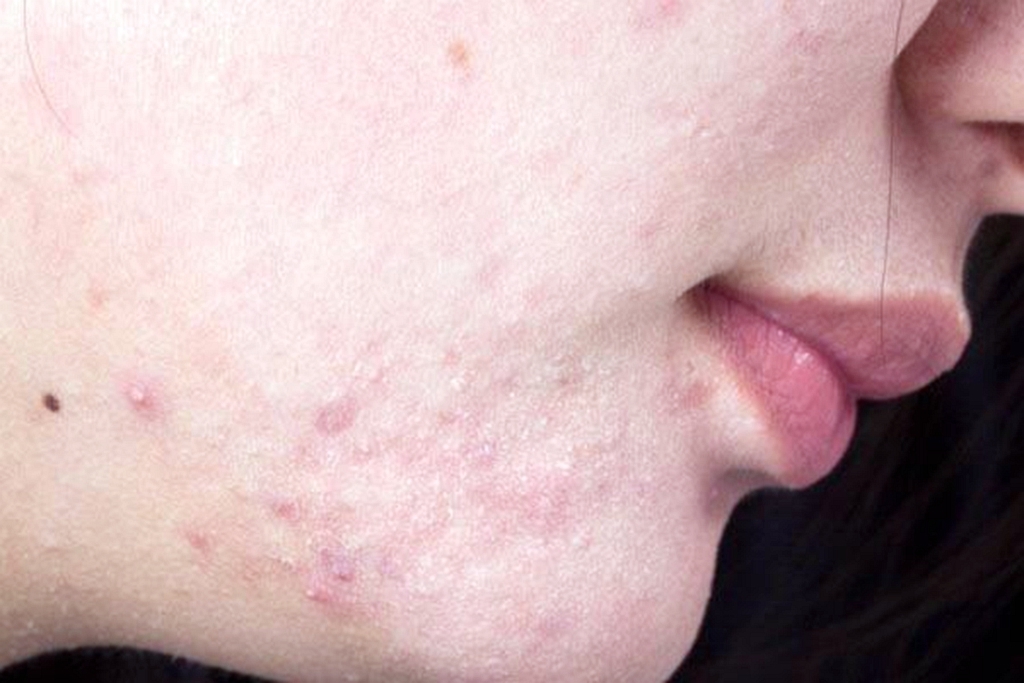 女性|女人有妇科病，嘴巴常会有几种表现暗示你，希望你一个都没有