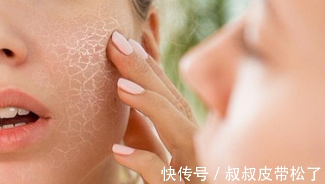 护肤 换季是改善皮肤的好时候,这些护肤技巧学会了,平稳度过换季期!